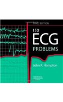 150 Ecg Problems