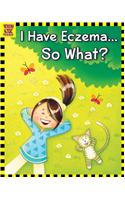 I Have Eczema... So What?