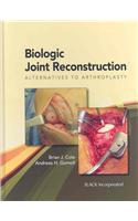 Biologic Joint Reconstruction