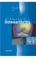 Many Faces of Osteoarthritis
