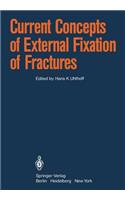 Current Concepts of External Fixation of Fractures