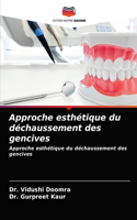 Approche esthétique du déchaussement des gencives