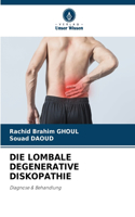 Die Lombale Degenerative Diskopathie
