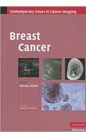 Breast Cancer