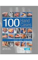 100 Hand Cases