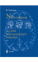 Neuroimaging in child neuropsychiatric disorders