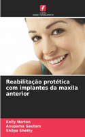 Reabilitação protética com implantes da maxila anterior