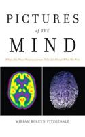 Pictures of the Mind