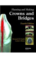 Planning and Making Crowns and Bridges