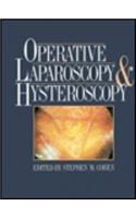 Operative Laparoscopy and Hysterectomy