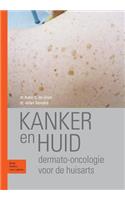 Kanker En Huid