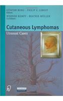 Cutaneous Lymphomas