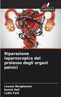 Riparazione laparoscopica del prolasso degli organi pelvici