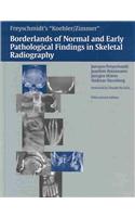 Koehler/Zimmer Borderlands of Normal and Early Pathological Findings in Skeletal Radiography