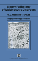 Biopsy Pathology of Melanocytic Disorders