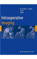 Intraoperative Imaging