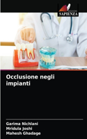 Occlusione negli impianti