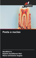 Posta e nucleo