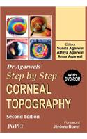 Dr Agarwal's Step by Step (R) Corneal Topography