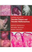 Color Atlas of Vascular Tumors and Vascular Malformations