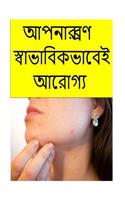 Cure Your Acne Naturally (Bengali)
