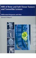 MRI of Bone and Soft Tissue Tumors and Tumorlike Lesions