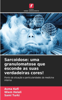 Sarcoidose