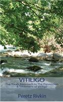 Vitiligo