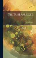 Tuberkulose; Volume 1