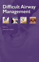 Difficult Airway Management: (Oxford Anaesthesia Library)