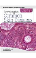 Roxburgh'S Common Skin Diseases