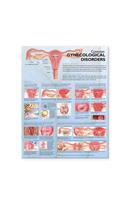 Common Gynecological Disorders Anatomical Chart