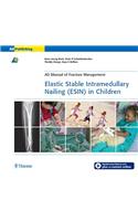 Elastic Stable Intramedullary Nailing (ESIN) in Children