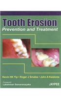 Tooth Erosion Prevention and Treatment