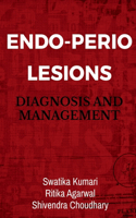 Endo-Perio Lesions