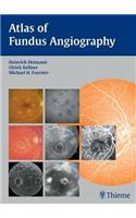 Atlas of Fundus Angiography