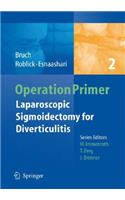 Laparoscopic Sigmoidectomy for Diverticulitis