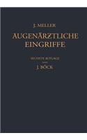 Augenärztliche Eingriffe