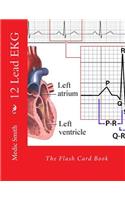 12 Lead EKG