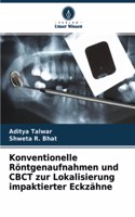 Konventionelle Röntgenaufnahmen und CBCT zur Lokalisierung impaktierter Eckzähne