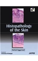 Histopathology of the Skin (with CD-ROM)