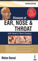 Diseases of Ear, Nose & Throat: With Head & Neck Surgery