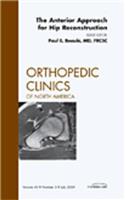 Anterior Approach for Hip Reconstruction, an Issue of Orthopedic Clinics