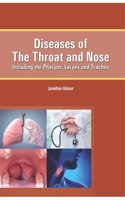 Diseases Of The Throat And Nose: Including The Pharynx, Larynx And Trachea