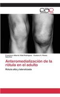 Anteromedialización de la rótula en el adulto