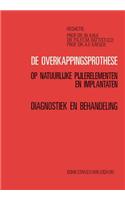 de Overkappingsprothese