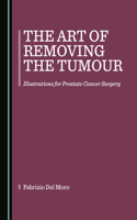 Art of Removing the Tumour: Illustrations for Prostate Cancer Surgery