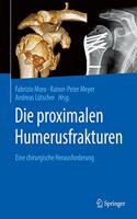 Die Proximalen Humerusfrakturen