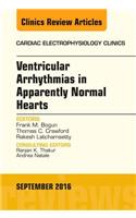 Ventricular Arrhythmias in Apparently Normal Hearts, an Issue of Cardiac Electrophysiology Clinics