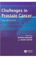 Challenges in Prostate Cancer